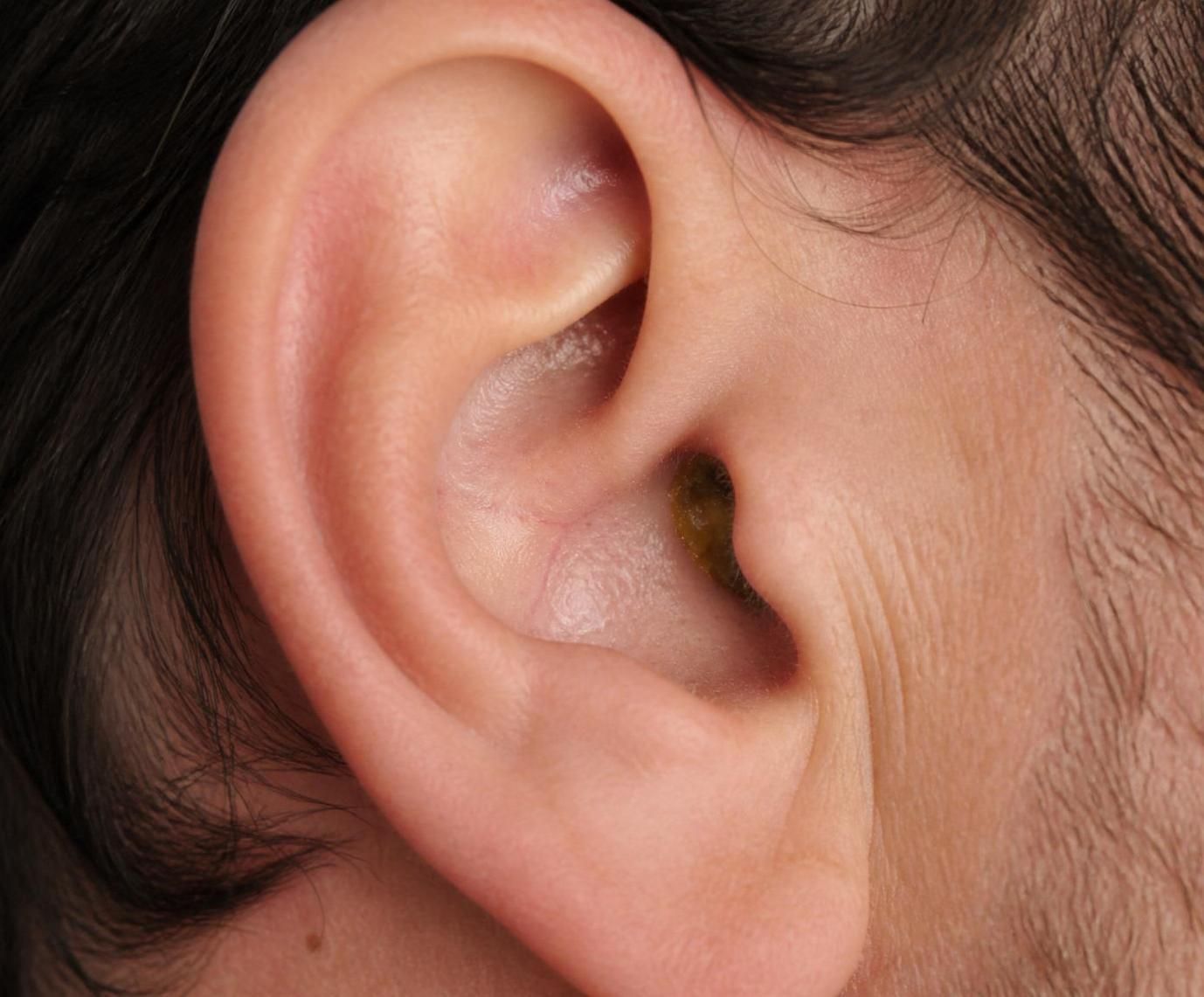 découvrez les symptômes liés à l'utilisation des bouchons d’oreille qui doivent vous alerter et savoir quand consulter un professionnel pour protéger votre audition.